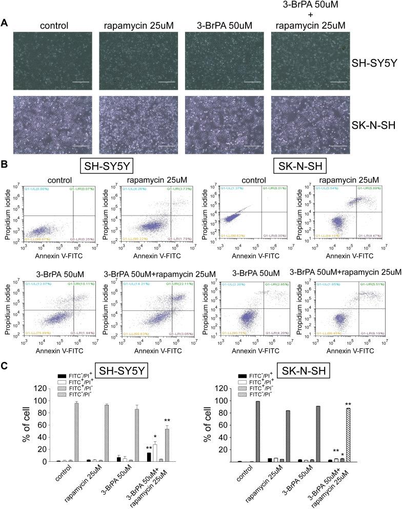 https://cdn.ncbi.nlm.nih.gov/pmc/blobs/29d2/7605667/600917d61443/OTT-13-11125-g0005.jpg