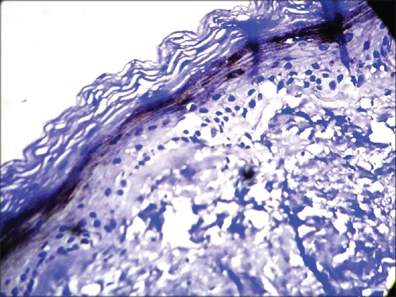 https://cdn.ncbi.nlm.nih.gov/pmc/blobs/29d7/6385539/c5e37d7752e8/IJABMR-9-27-g003.jpg