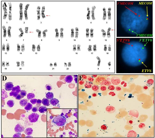 https://cdn.ncbi.nlm.nih.gov/pmc/blobs/29d8/12006008/ec52a4b3a75f/fonc-15-1526044-g002.jpg