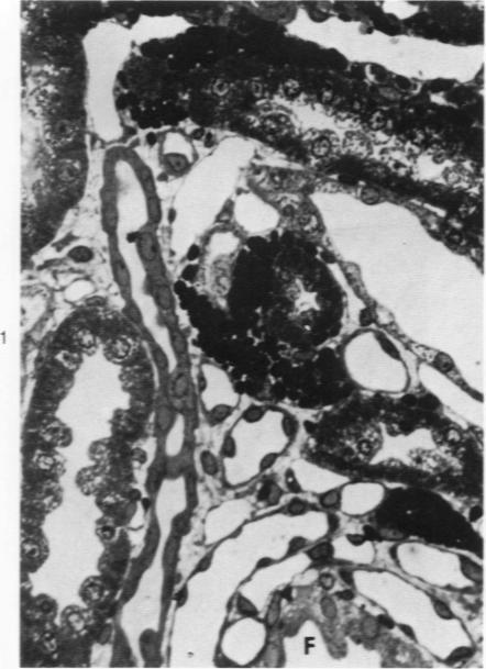 https://cdn.ncbi.nlm.nih.gov/pmc/blobs/29dc/2032089/93260eef6956/amjpathol00402-0158-a.jpg