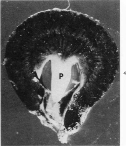https://cdn.ncbi.nlm.nih.gov/pmc/blobs/29dc/2032089/b64b65f62b7a/amjpathol00402-0160-a.jpg