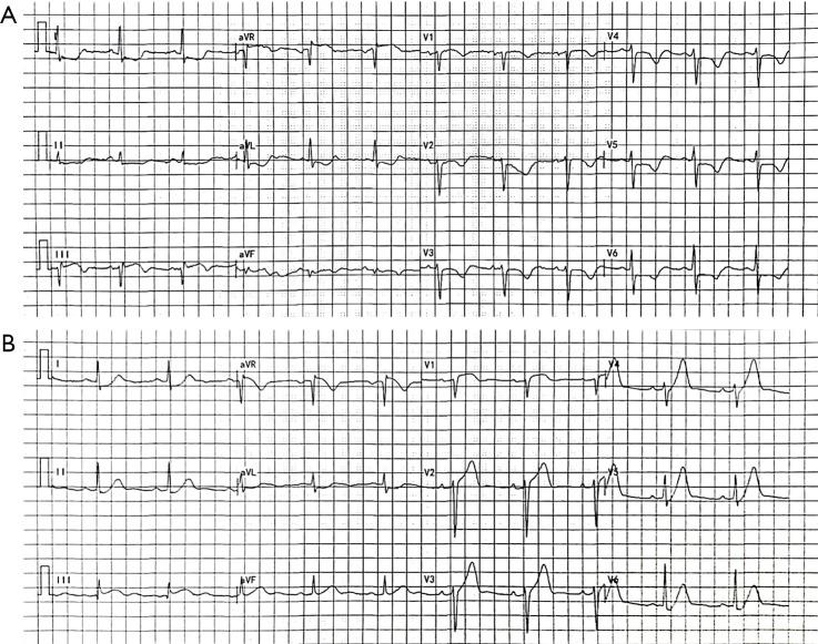 https://cdn.ncbi.nlm.nih.gov/pmc/blobs/29ec/11228738/95b1adcd3b04/jtd-16-06-4000-f1.jpg