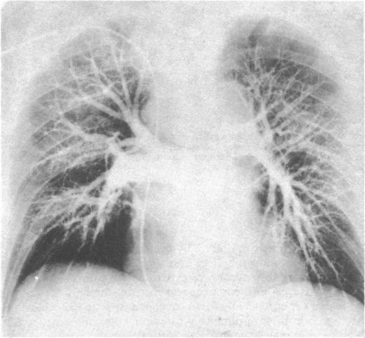 https://cdn.ncbi.nlm.nih.gov/pmc/blobs/29f4/1588813/b12e429d49d7/brmedj01538-0043-a.jpg