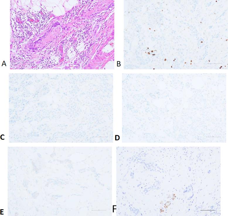 https://cdn.ncbi.nlm.nih.gov/pmc/blobs/29f9/11915217/571c6b18f4e9/fonc-15-1548036-g002.jpg