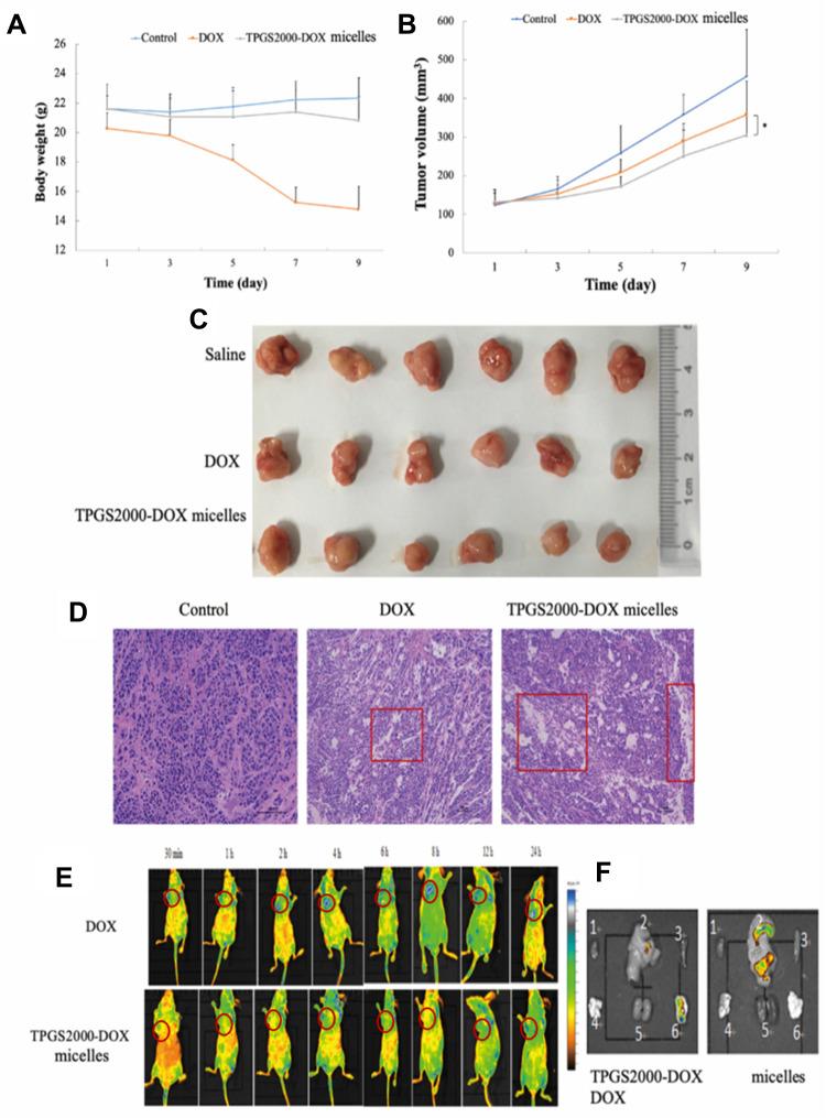 https://cdn.ncbi.nlm.nih.gov/pmc/blobs/29fa/8647655/894adc8b430d/IJN-16-7875-g0007.jpg
