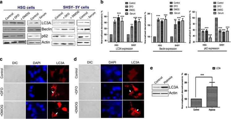 https://cdn.ncbi.nlm.nih.gov/pmc/blobs/29fe/4385947/882a7fce9f6a/cddis20157f1.jpg