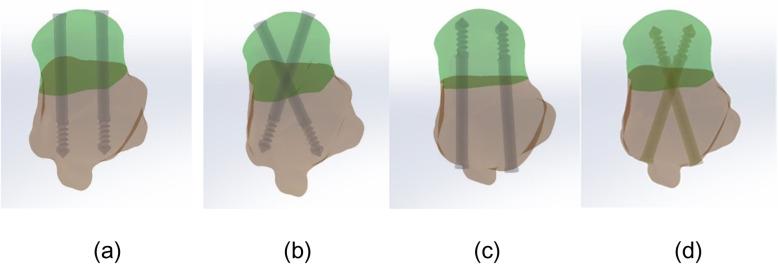 https://cdn.ncbi.nlm.nih.gov/pmc/blobs/2a01/7014601/5bc2e6cc1e72/13018_2020_1560_Fig2_HTML.jpg