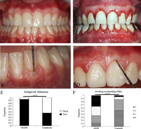 https://cdn.ncbi.nlm.nih.gov/pmc/blobs/2a02/3323826/7e0858073961/bmjopen-2011-000705fig2.jpg