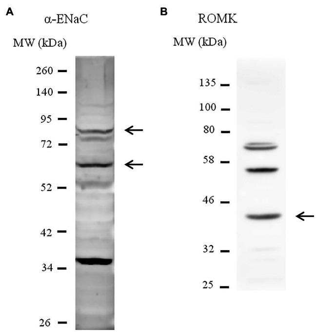 https://cdn.ncbi.nlm.nih.gov/pmc/blobs/2a02/8160308/fcad679c6b93/fphys-12-642409-g001.jpg