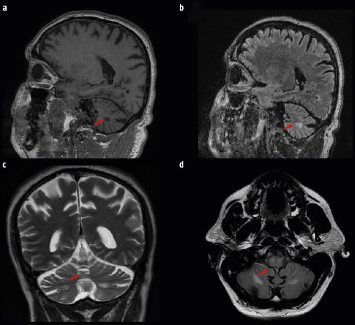 https://cdn.ncbi.nlm.nih.gov/pmc/blobs/2a06/10364044/6b49eb6532c4/RN-76-75-g001.jpg