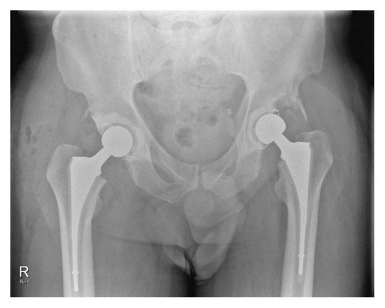 https://cdn.ncbi.nlm.nih.gov/pmc/blobs/2a09/5259669/1f26c08a1ae8/CRIOR2017-3809732.005.jpg