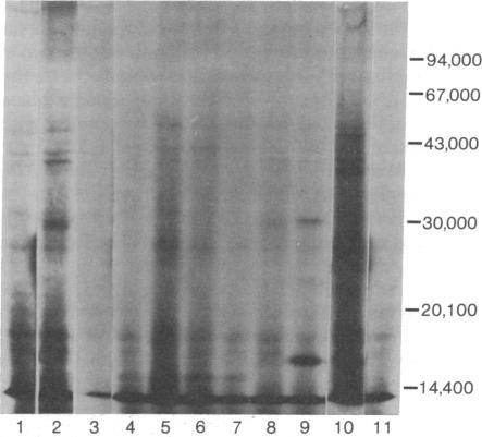 https://cdn.ncbi.nlm.nih.gov/pmc/blobs/2a11/349463/8b774711e01c/pnas00492-0323-a.jpg