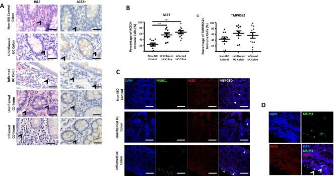 https://cdn.ncbi.nlm.nih.gov/pmc/blobs/2a1e/8956554/8e5d731b1f47/10753_2021_1567_Fig2_HTML.jpg