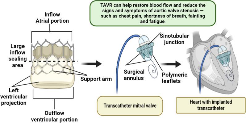 https://cdn.ncbi.nlm.nih.gov/pmc/blobs/2a26/10082141/20c1d917b0d1/43044_2023_345_Fig8_HTML.jpg