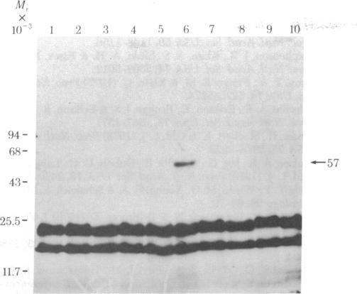 https://cdn.ncbi.nlm.nih.gov/pmc/blobs/2a29/349589/ac9848faa6c4/pnas00493-0179-b.jpg