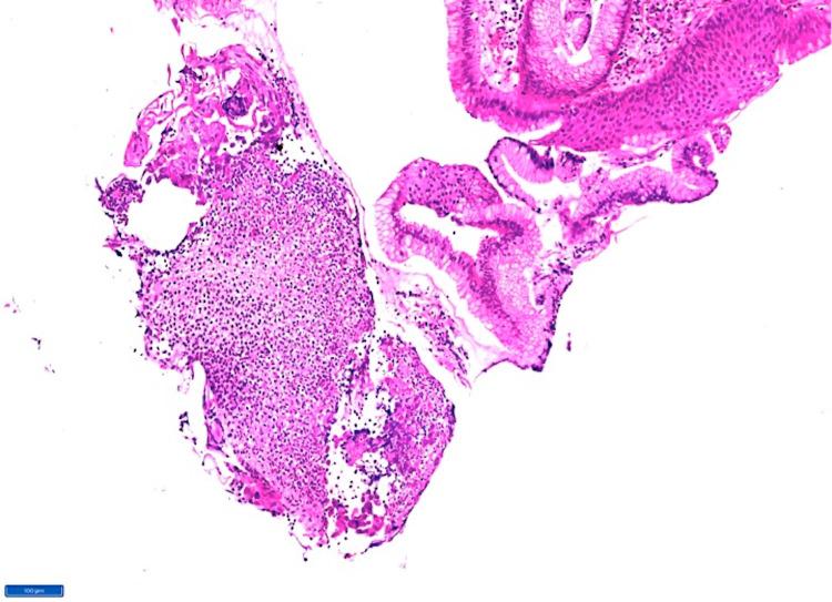 https://cdn.ncbi.nlm.nih.gov/pmc/blobs/2a2c/8278358/a0c4f4aeb484/cureus-0013-00000015635-i01.jpg