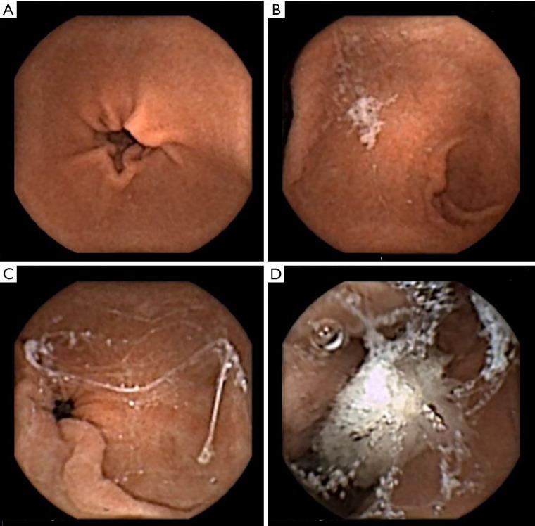 https://cdn.ncbi.nlm.nih.gov/pmc/blobs/2a2d/8033325/6de85297486c/atm-09-05-411-f1.jpg