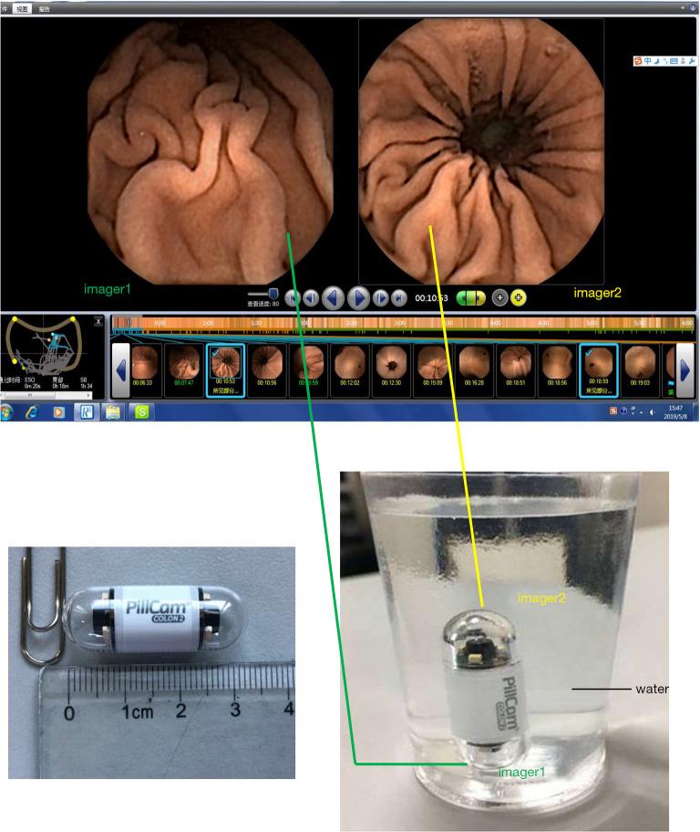https://cdn.ncbi.nlm.nih.gov/pmc/blobs/2a2d/8033325/7add364ec32d/atm-09-05-411-f3.jpg