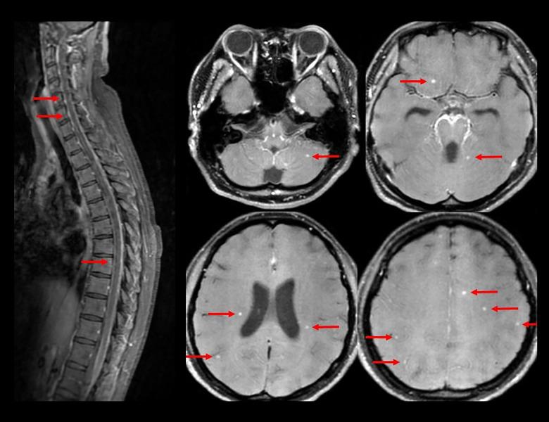 https://cdn.ncbi.nlm.nih.gov/pmc/blobs/2a37/12366473/f8580480b753/amjcaserep-26-e947502-g002.jpg