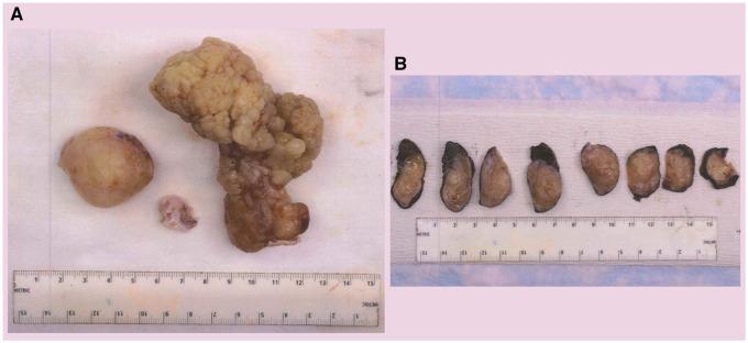 https://cdn.ncbi.nlm.nih.gov/pmc/blobs/2a38/8343455/79182ccd2cc3/ytab258f4.jpg