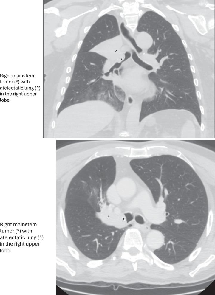 https://cdn.ncbi.nlm.nih.gov/pmc/blobs/2a3b/11521487/17876c51207b/cro-2024-0017-0001-540889_F01.jpg