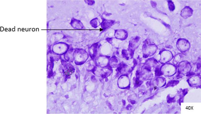 https://cdn.ncbi.nlm.nih.gov/pmc/blobs/2a3f/8934839/04a34fa90b60/11571_2021_9718_Fig9_HTML.jpg