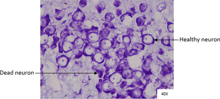 https://cdn.ncbi.nlm.nih.gov/pmc/blobs/2a3f/8934839/a92939660389/11571_2021_9718_Fig13_HTML.jpg