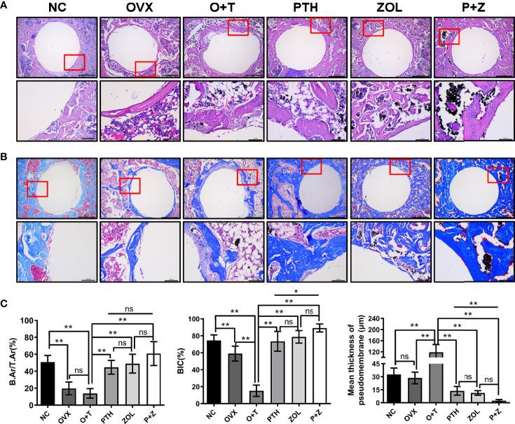 https://cdn.ncbi.nlm.nih.gov/pmc/blobs/2a42/9084285/5ced96e2d6ce/fendo-13-871380-g004.jpg