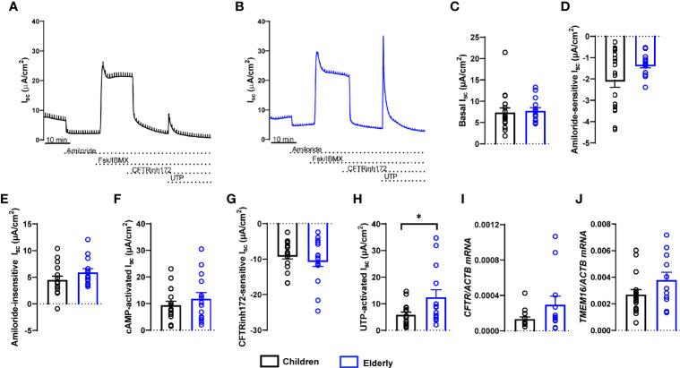 https://cdn.ncbi.nlm.nih.gov/pmc/blobs/2a49/8918506/ae0302f0652d/fimmu-13-822437-g002.jpg