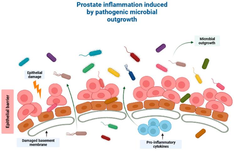 https://cdn.ncbi.nlm.nih.gov/pmc/blobs/2a4d/10452611/ae35f45325eb/cancers-15-04086-g001.jpg