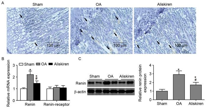 https://cdn.ncbi.nlm.nih.gov/pmc/blobs/2a4e/5646976/14134e0c1e07/MMR-16-04-3965-g03.jpg