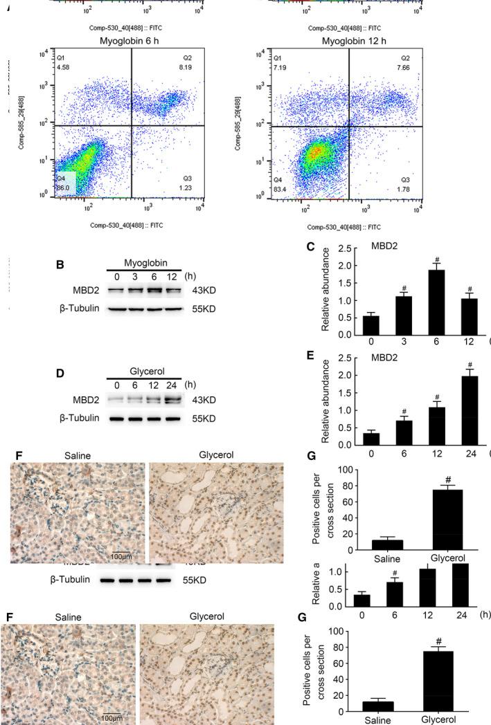 https://cdn.ncbi.nlm.nih.gov/pmc/blobs/2a52/8107094/099e946f9bc6/JCMM-25-4562-g006.jpg