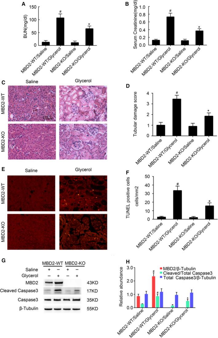 https://cdn.ncbi.nlm.nih.gov/pmc/blobs/2a52/8107094/d351be4cd355/JCMM-25-4562-g005.jpg