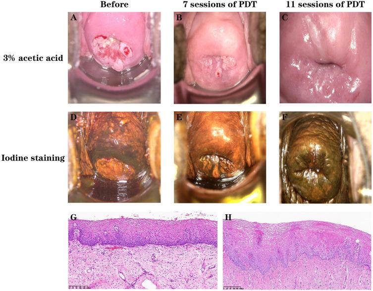 https://cdn.ncbi.nlm.nih.gov/pmc/blobs/2a56/11410032/b07472bc2c51/CCID-17-2071-g0002.jpg