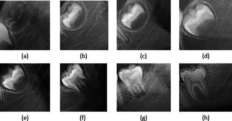 https://cdn.ncbi.nlm.nih.gov/pmc/blobs/2a5d/11156840/7c6f31cf3aa7/41598_2024_63744_Fig2_HTML.jpg