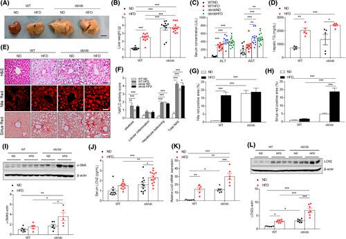 https://cdn.ncbi.nlm.nih.gov/pmc/blobs/2a67/9936980/3c79decc57af/hep-77-0888-g003.jpg