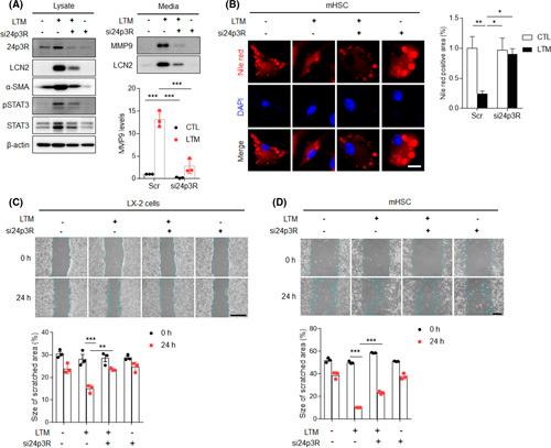 https://cdn.ncbi.nlm.nih.gov/pmc/blobs/2a67/9936980/68ebb882ac82/hep-77-0888-g009.jpg