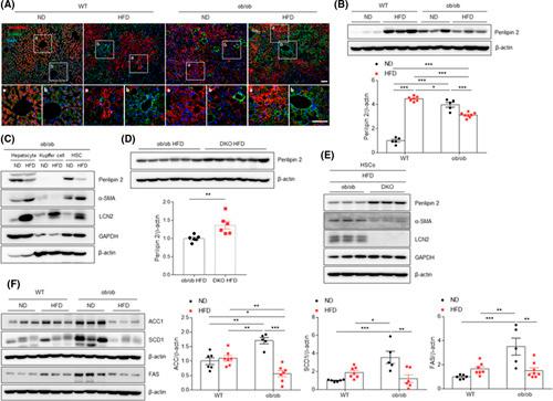 https://cdn.ncbi.nlm.nih.gov/pmc/blobs/2a67/9936980/77e20e91b15b/hep-77-0888-g007.jpg