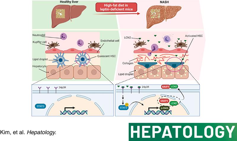 https://cdn.ncbi.nlm.nih.gov/pmc/blobs/2a67/9936980/a06abd320ab0/hep-77-0888-g001.jpg