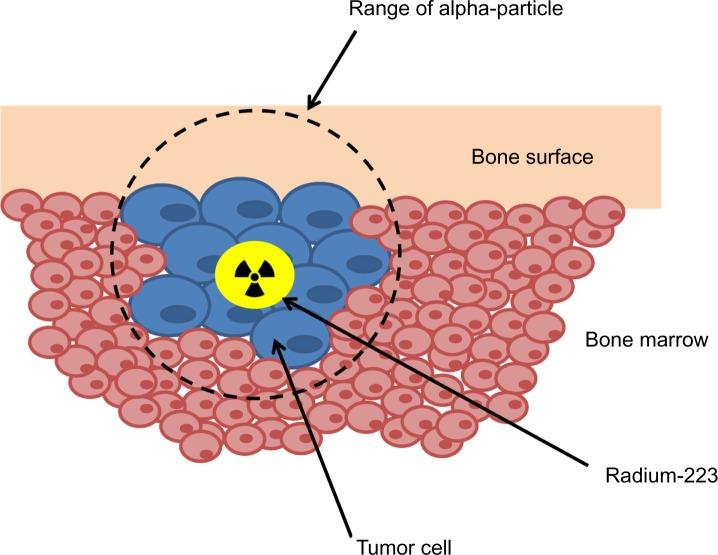 https://cdn.ncbi.nlm.nih.gov/pmc/blobs/2a72/4043797/f387af7c753d/tcrm-10-373Fig1.jpg