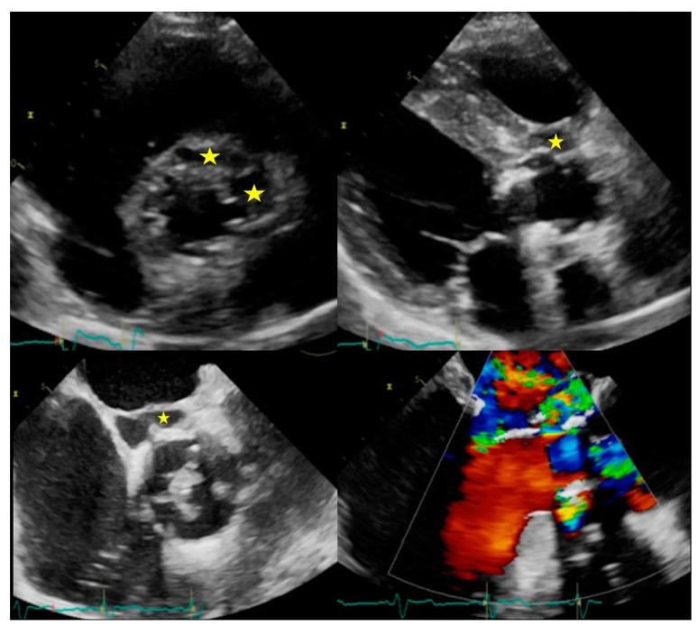 https://cdn.ncbi.nlm.nih.gov/pmc/blobs/2a72/7408824/940669b97fef/jcm-09-02237-g002.jpg
