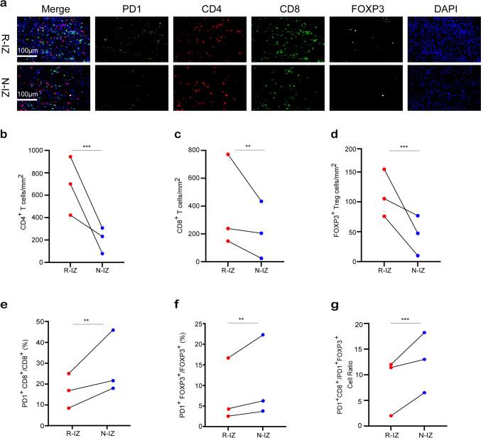 https://cdn.ncbi.nlm.nih.gov/pmc/blobs/2a73/11822157/dfba532083cc/262_2025_3962_Fig4_HTML.jpg