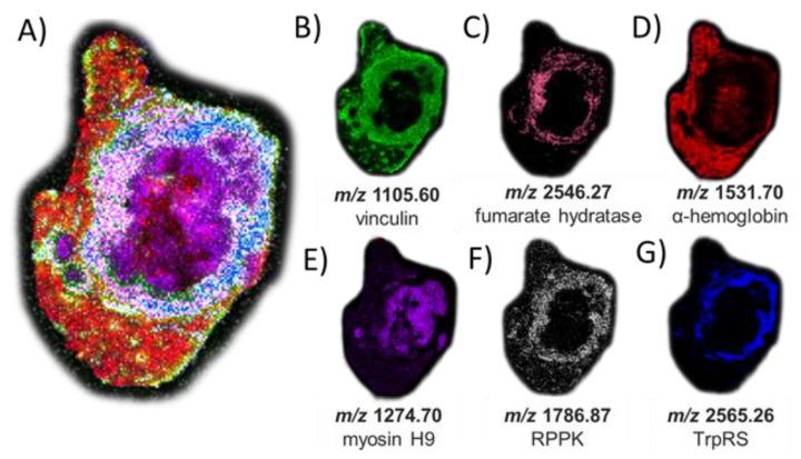 https://cdn.ncbi.nlm.nih.gov/pmc/blobs/2a73/9954453/8354482ecc75/cancers-15-01224-g005.jpg