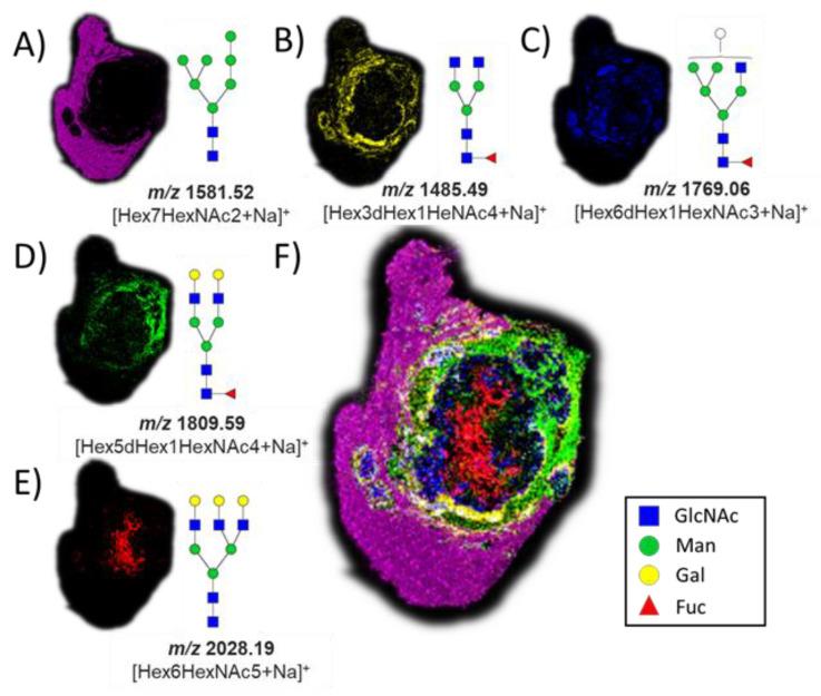 https://cdn.ncbi.nlm.nih.gov/pmc/blobs/2a73/9954453/b8fdc2da01bf/cancers-15-01224-g003.jpg