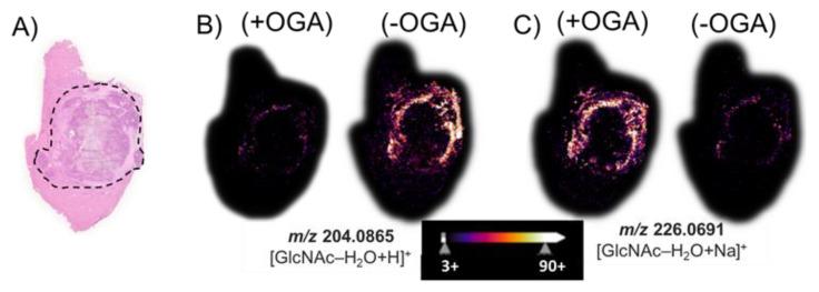 https://cdn.ncbi.nlm.nih.gov/pmc/blobs/2a73/9954453/ca2379638f19/cancers-15-01224-g004.jpg