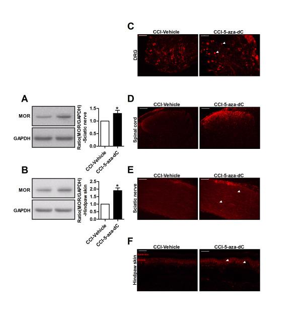 https://cdn.ncbi.nlm.nih.gov/pmc/blobs/2a79/4137045/e17cabc36953/1744-8069-10-51-6.jpg