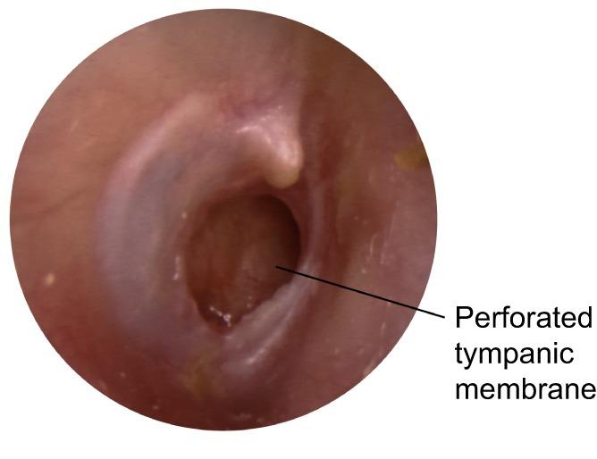 https://cdn.ncbi.nlm.nih.gov/pmc/blobs/2a79/5719252/2b8831158b16/dmm-10-029983-g2.jpg