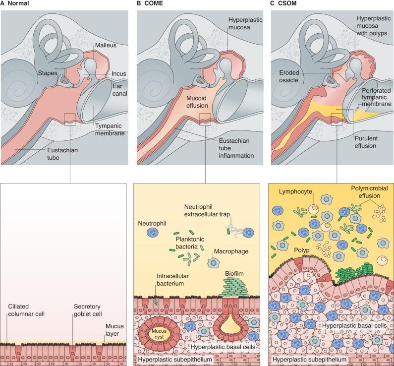 https://cdn.ncbi.nlm.nih.gov/pmc/blobs/2a79/5719252/44989f5f4c02/dmm-10-029983-g5.jpg