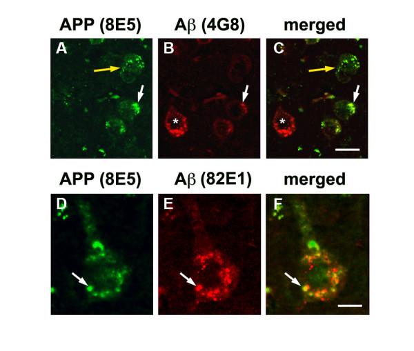 https://cdn.ncbi.nlm.nih.gov/pmc/blobs/2a7a/2596170/09fab9bc6528/1471-2202-9-109-4.jpg