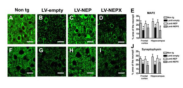 https://cdn.ncbi.nlm.nih.gov/pmc/blobs/2a7a/2596170/97748f7615eb/1471-2202-9-109-6.jpg